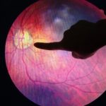 retinopatia-diabetica-principal-causa-de-problemas-de-vision-en-mexico