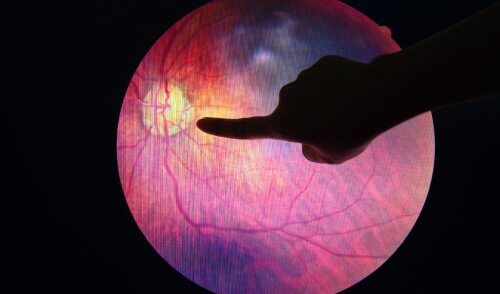 retinopatia-diabetica-principal-causa-de-problemas-de-vision-en-mexico